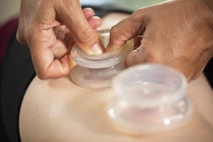 Hand placing silicone cupping disc on a person's low back.